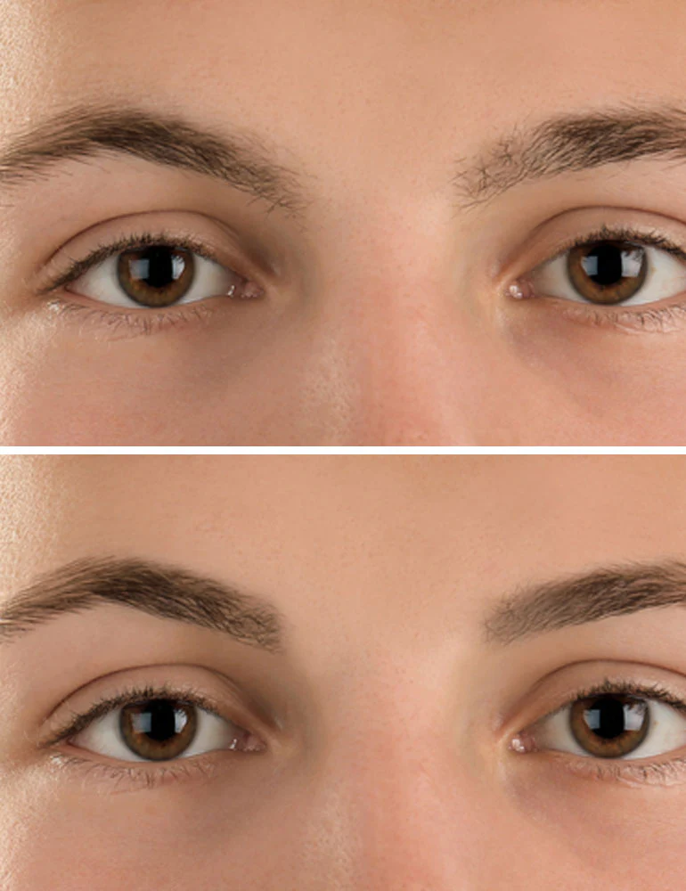 eyebrow-before-after