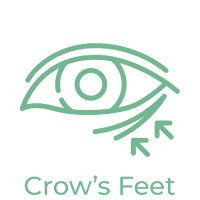 crows-feet